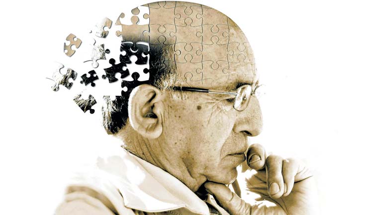 Avances médicos sobre el Alzheimer