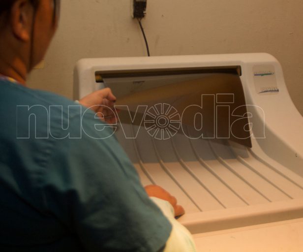 Radiología del Hospital de Coro opera a media máquina