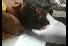 Photo of Herido pescador de machetazos en la cabeza