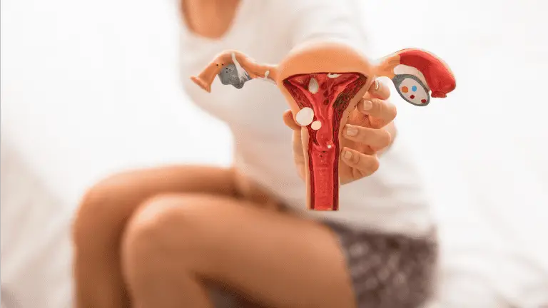 ¿Sabes qué es endometriosis? Destapan mitos en la ciudad de Coro