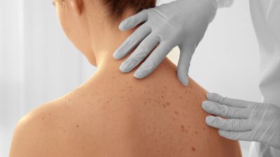 Dermatología: ¿vanidad o prevención?