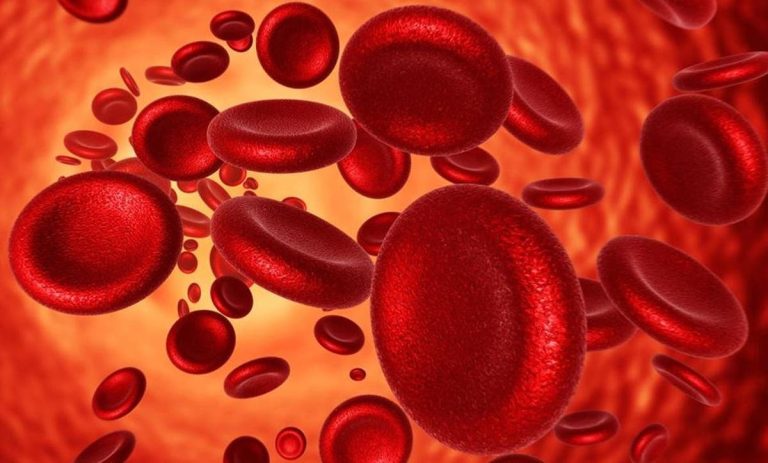 Conoce| ¿Qué es y en qué consiste la anemia ferropénica?