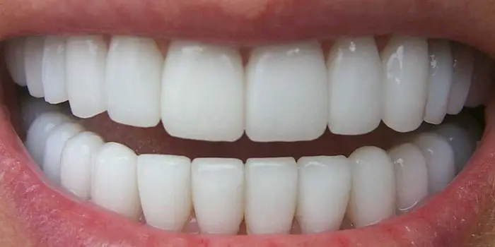 ¿Cómo eliminar el sarro de los dientes de forma natural?