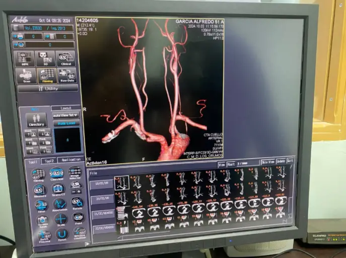 Los pacientes del estado Falcón que requieren de estudios especializados cuentan con un resonador y un tomógrafo en la Clínica Los Orumos de Coro.