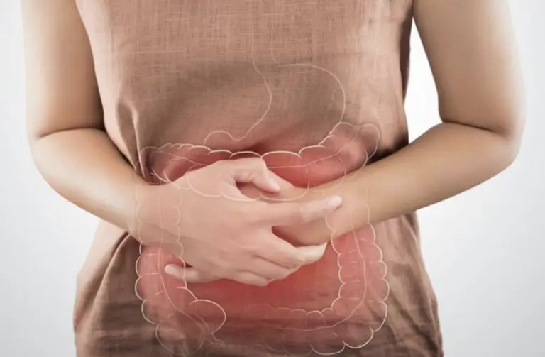 ¿Colon irritable? Alimentos que debe incluir en su dieta para desinflamarlo