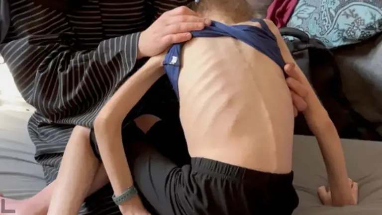 Aumenta la desnutrición en Gaza tras bloqueo de Israel