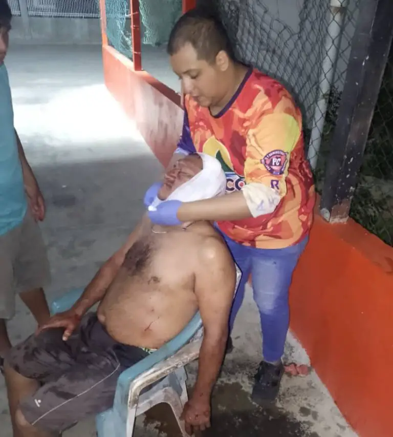 Riña en Punto Fijo | Herido hombre con un pico de botella
