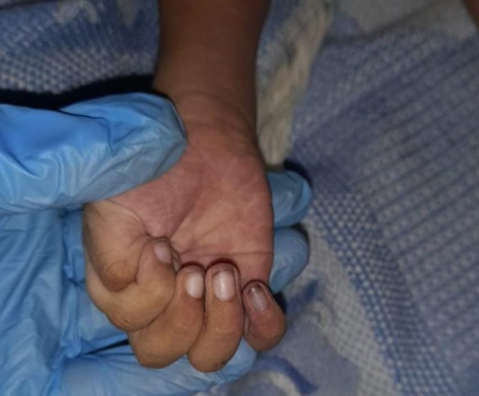 suicidio de niño