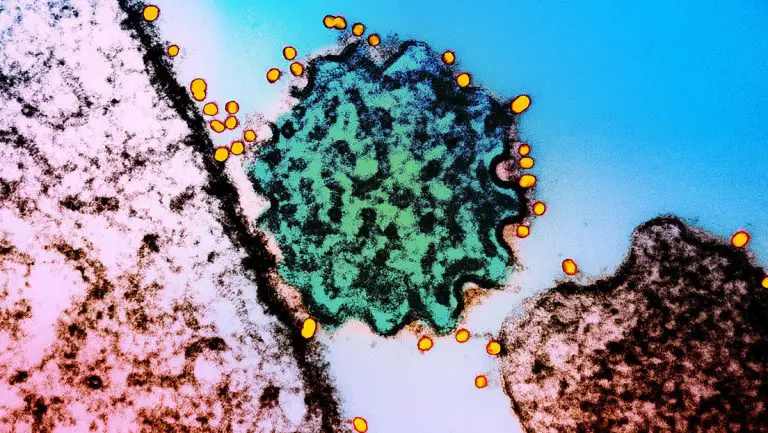 ¿Cuál es el peligro y los síntomas del virus Nipah? Esto se sabe