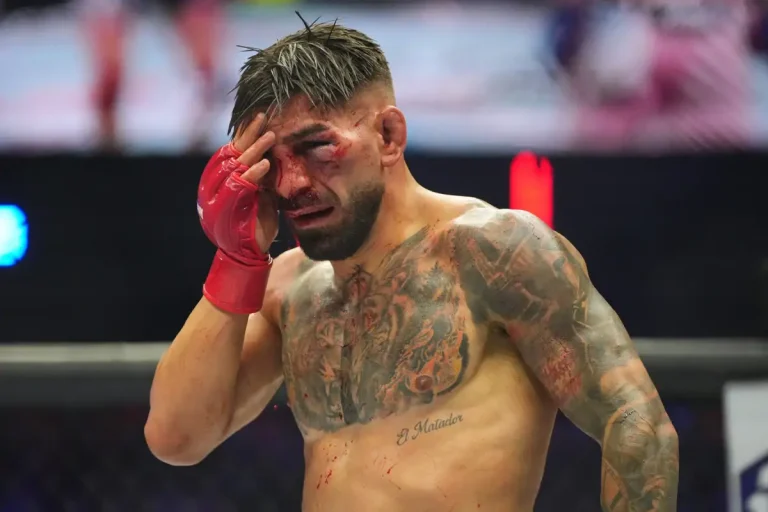 Entérate | Así quedó Topuria tras combate en la Casa Blanca