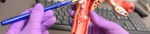 Control ginecológico anual, clave para prevenir el cáncer de cuello uterino