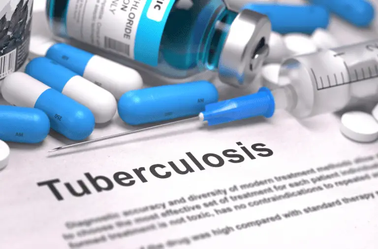 Carirubana cerró agosto con 34 pacientes contagiados de tuberculosis