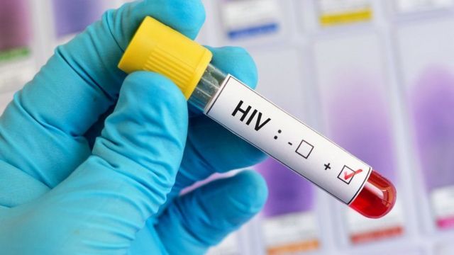 Hasta 2 pacientes mensuales con VIH registra Paraguaná