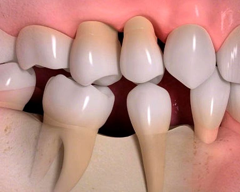 Científicos venezolanos regeneran pulpa dental